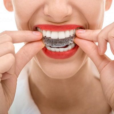 Can Aligners Damaged Teeth