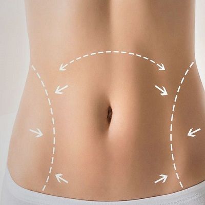 Liposuction & Tummy Tuck in Dubai