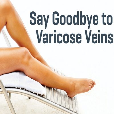 Varicose Veins Treatment: Leg Prevention