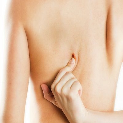 What to Expect After Getting Skin Tag Removal in Dubai