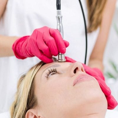 Microdermabrasion in dubai