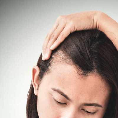 Hair Fall No More: The Best Treatment Options