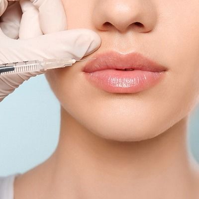 Dermal Fillers vs Neuramis Which is Better In Dubai