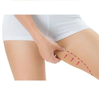Thigh Lift in Dubai