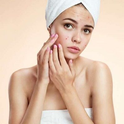Acne Scars Treatment for Sensitive Skin