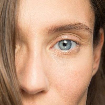 Brighten Your Eyes: Effective Dark Circles Treatment Solutions