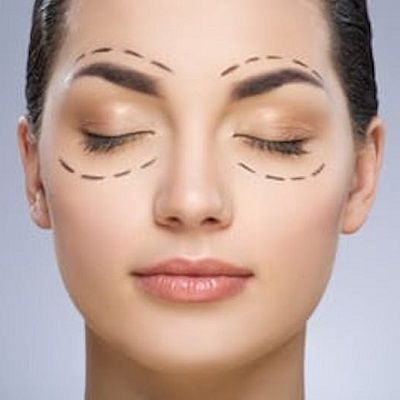 Causes of Droopy Eyelids 