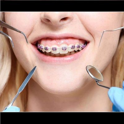 Dentist vs Orthodontist: What is the difference between a Dentist and an Orthodontist?
