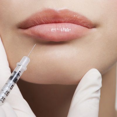 Dermal Fillers: How Fast Does Juvederm Start To Work?