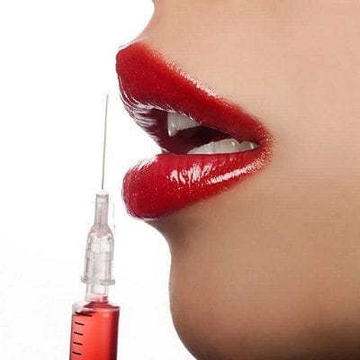 Everything You Need to Know About Russian Lip Filler