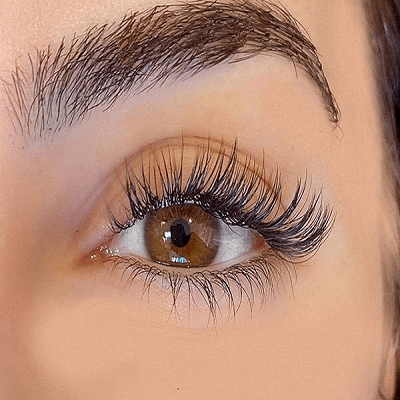 How To Get The Eyelashes Back With A Hair Transplant In Dubai?