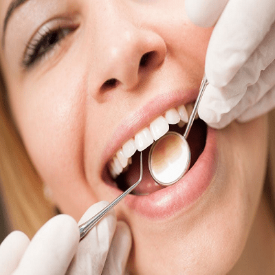 How to Make Your Teeth Cleaning Last Longer In Dubai?