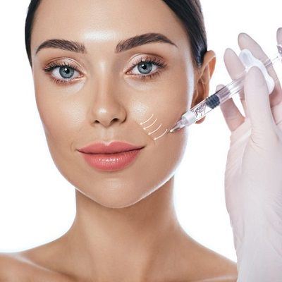How to Smooth Away Laugh Lines with Dermal Fillers