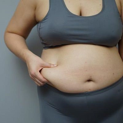 Is Weight Loss Surgery a Permanent Solution for Obesity?