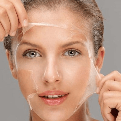 Which is Better Carbon Laser or Chemical Peel?