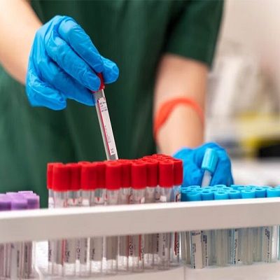 Blood Tests for CPS at Home in Dubai, Abu Dhabi & Sharjah