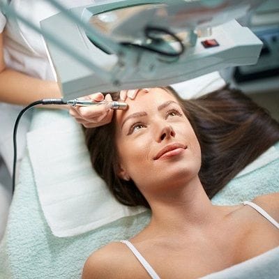 Excimer Laser Treatment