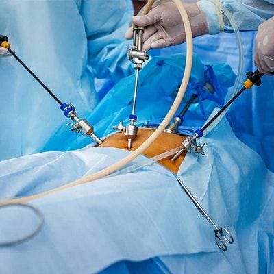 Laparoscopic Surgery: Advantages and Disadvantages