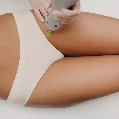 Revitalize Your Relationship: The Magic of Laser Vaginal Tightening In Dubai