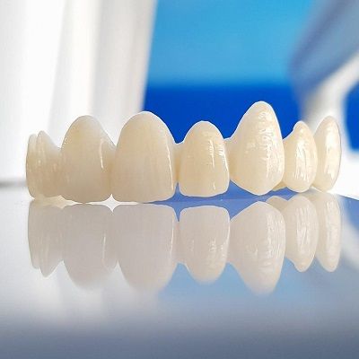 Ceramic Crowns in Dubai: A Painless Path to Picture-Perfect Teeth