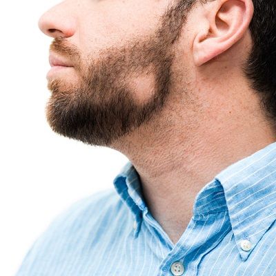 Fix Patchy Beard Growth And Grow a Full Beard?
