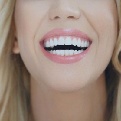 Smile Brighter & Whiter With Teeth Cleaning in Dubai Hidden Gem