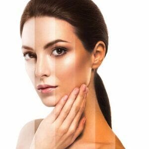 Tan Removal For All Skin Types In Dubai