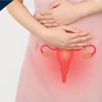 Laparoscopic Ovarian Cystectomy in Dubai