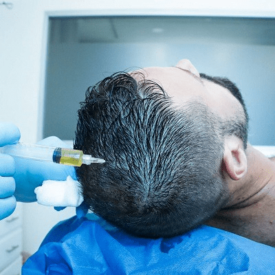PRP Hair Restoration in Dubai