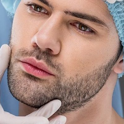What’s The Best Age To Get A Beard Transplant In Dubai?