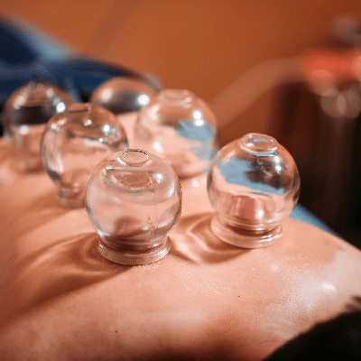 Hijama in Dubai