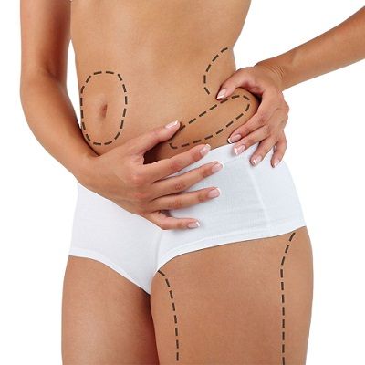 Remove stubborn Fat With Lipotropic Injections