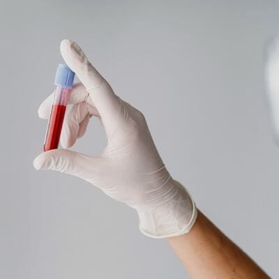 Are Blood Tests Reliable for Analysing Body Health in Dubai?