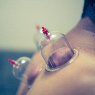 Hijama For Asthma In Dubai