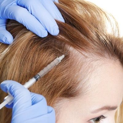 The Journey to Fuller Hair: Best PRP Treatment