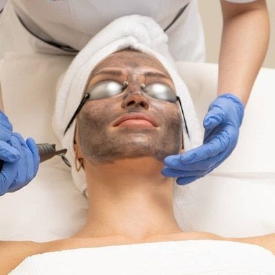 Achieve Radiant Skin with Spectra Laser Carbon Peel