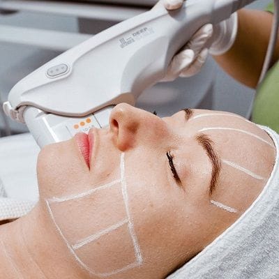 Explore Options for a Younger You with SMAS Lift in Dubai