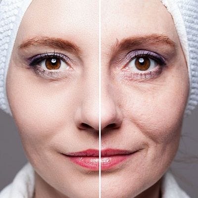 Treat Your Skin Concerns with Pico Laser Treatment