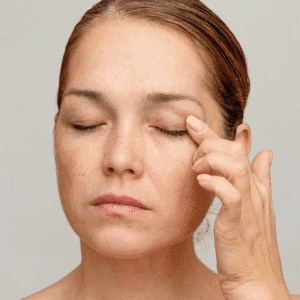 How To Fix Hooded Upper Eyelids