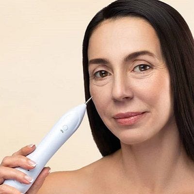 Plasma Pen for Non Surgical Face Contouring