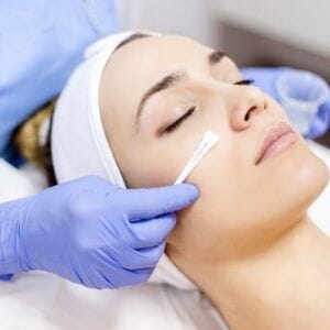 How Does Dermamelan Peel Control Skin Pigment?