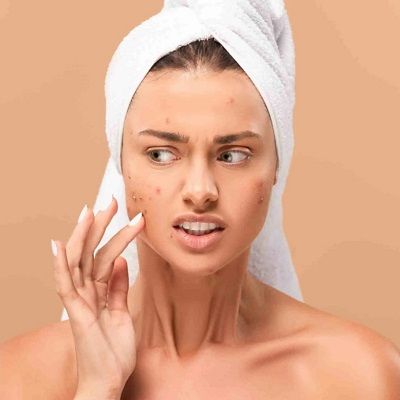 Acne Scar Removal Dubai Investments Park