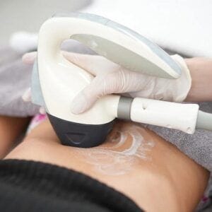 Can Velashape 3 Treatment Burn Belly Fat?