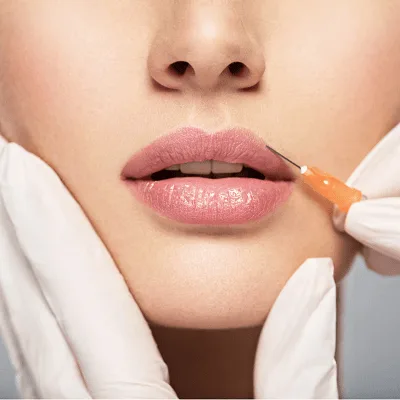 Russian Lip Fillers in Dubai