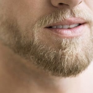Can Beard Hair Be Used for a Mustache Transplant?