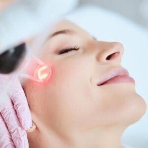 Does Pico Laser Treatment Remove Freckles?