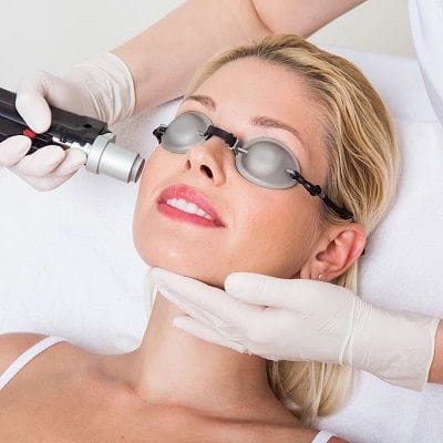 Radio Frequency for Acne Scars in Dubai