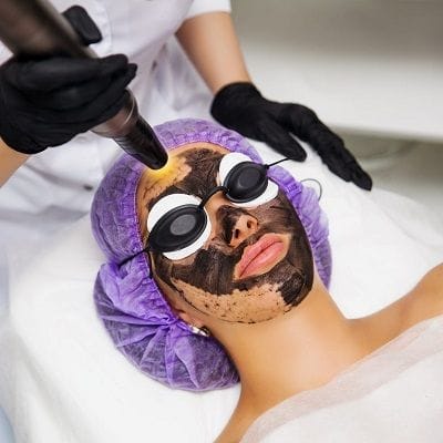 Spectra Laser Carbon Peel in Dubai