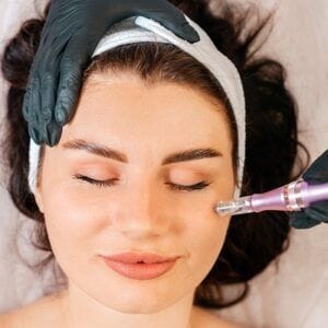 How Long Do Dermapen Results Last?