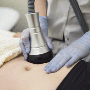 How Many Laser Lipo Sessions Are Needed?